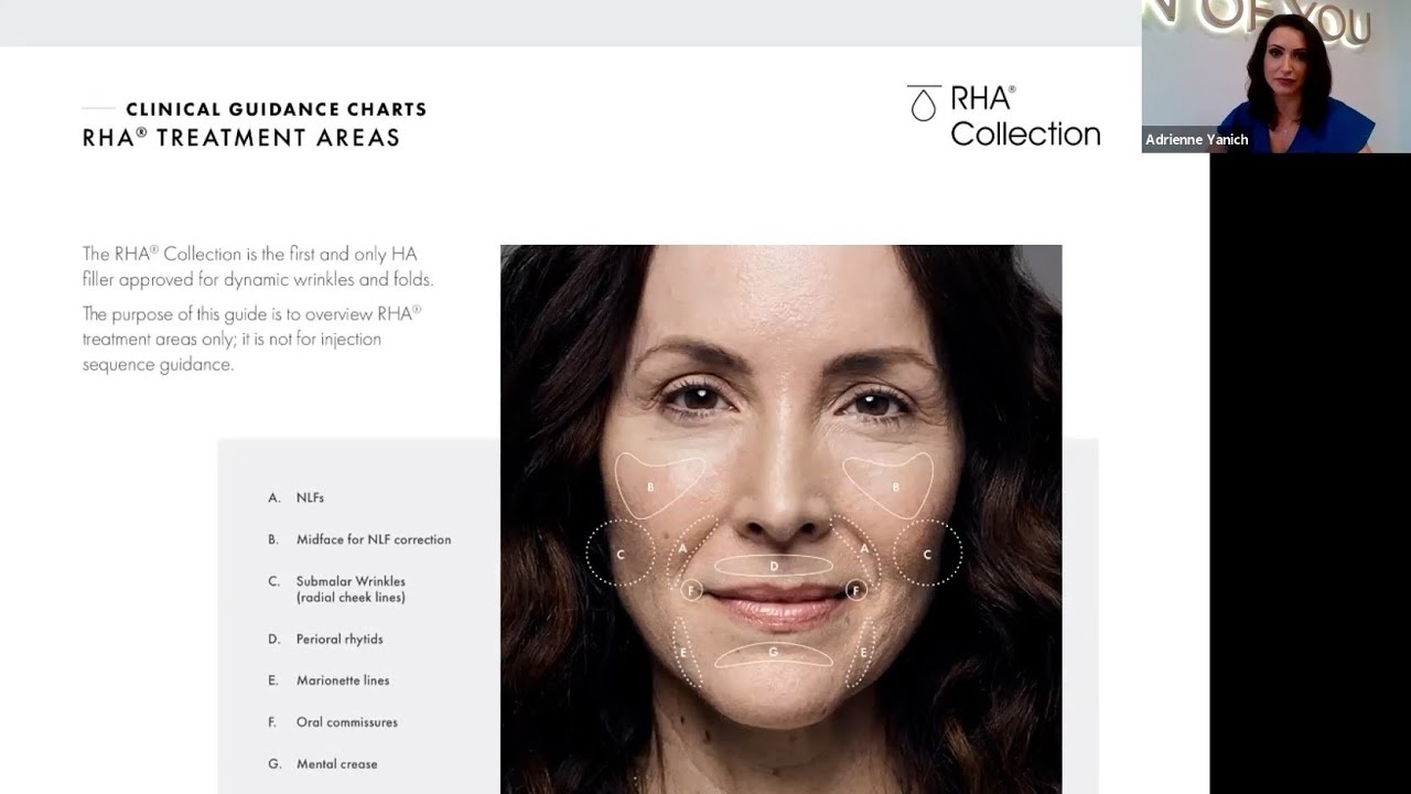 Introducing the RHA Collection of Fillers