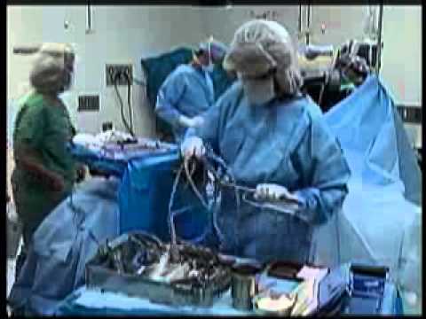 Dr. Donaldson Explains Scarless Breast Augmentation in Columbus,OH