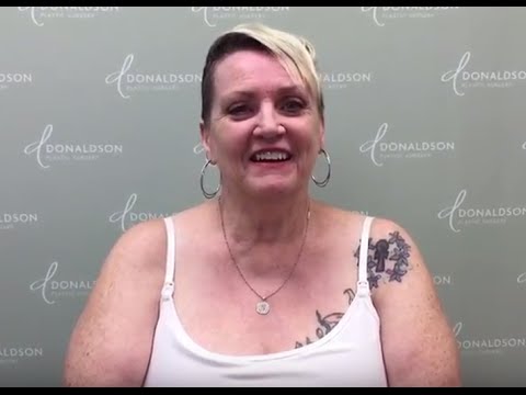 Columbus, Ohio Arm Lift Patient Feels So Confident