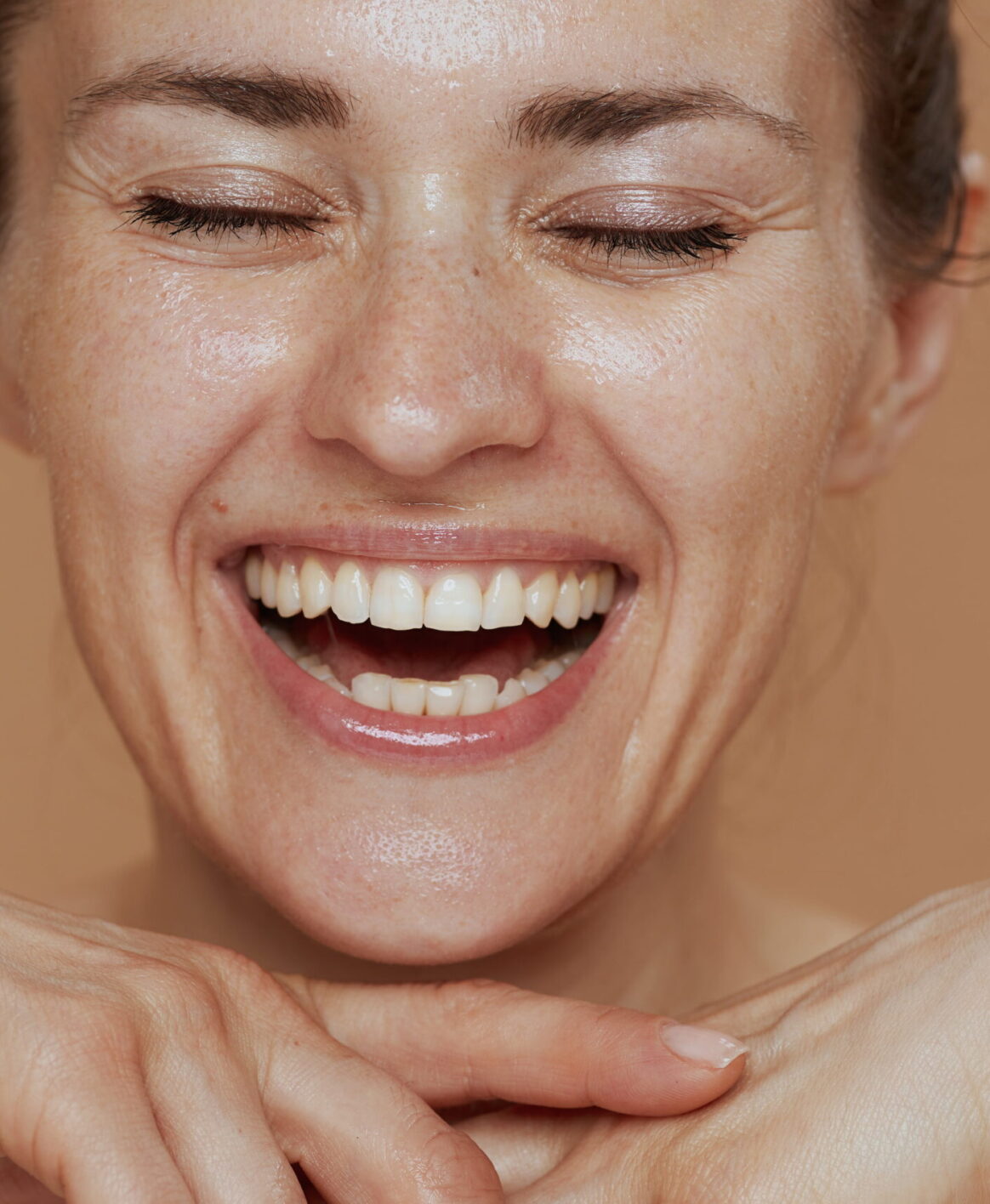 The Perfect Derma Peel Patient Smiling