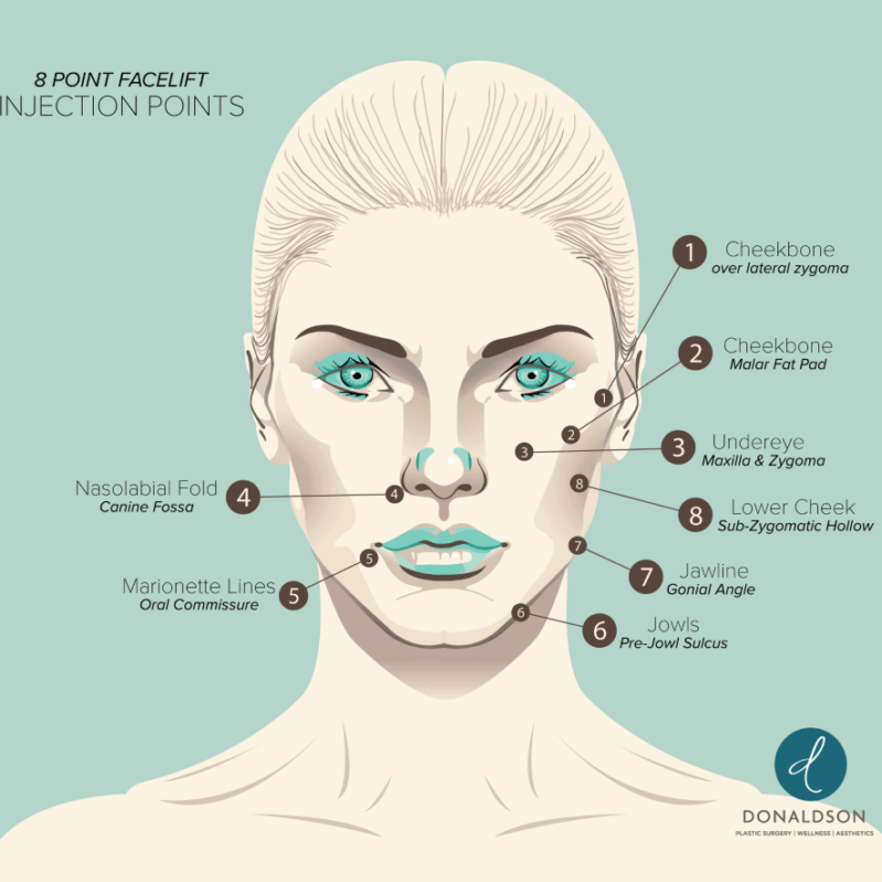 What Is The 8 Point Facelift? 