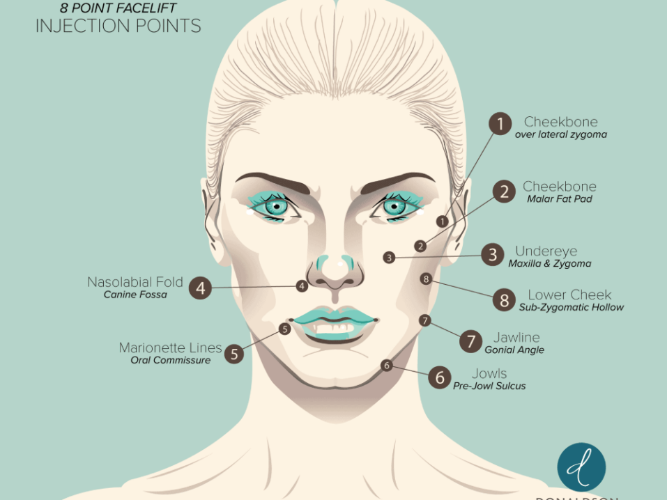 What Is The 8 Point Facelift? 