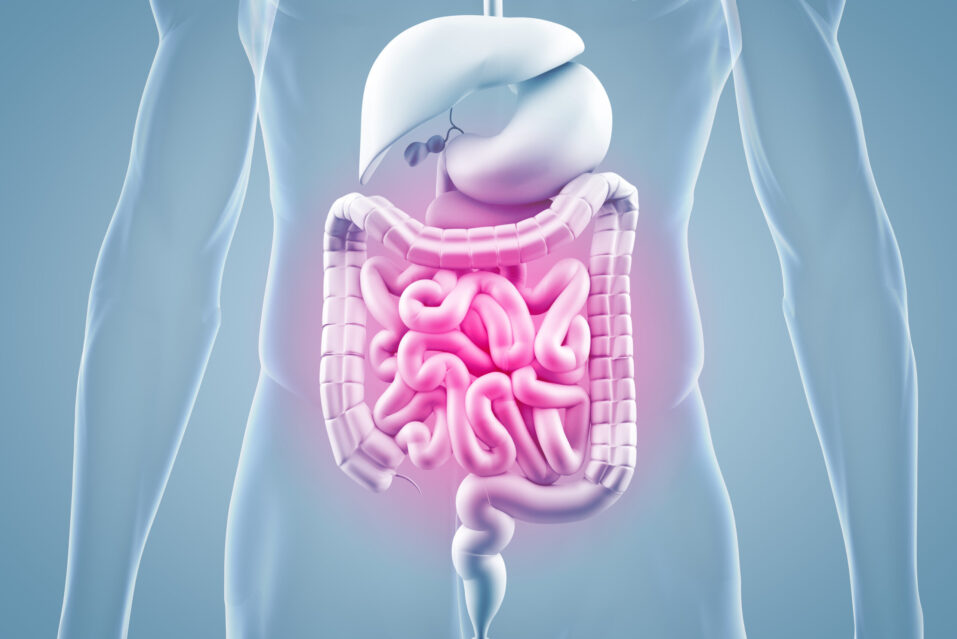 Leaky Gut Syndrome