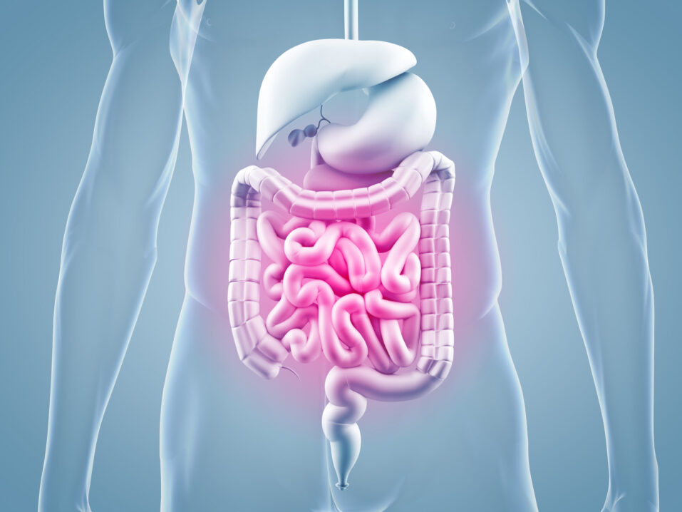 Leaky Gut Syndrome