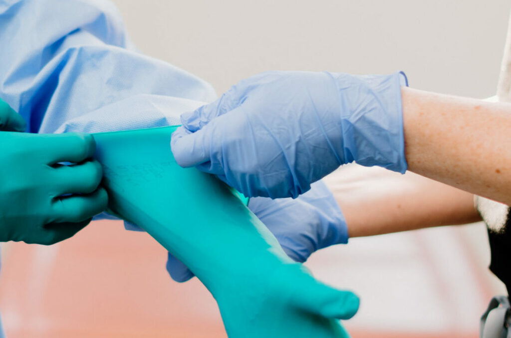 Tightening a surgical glove