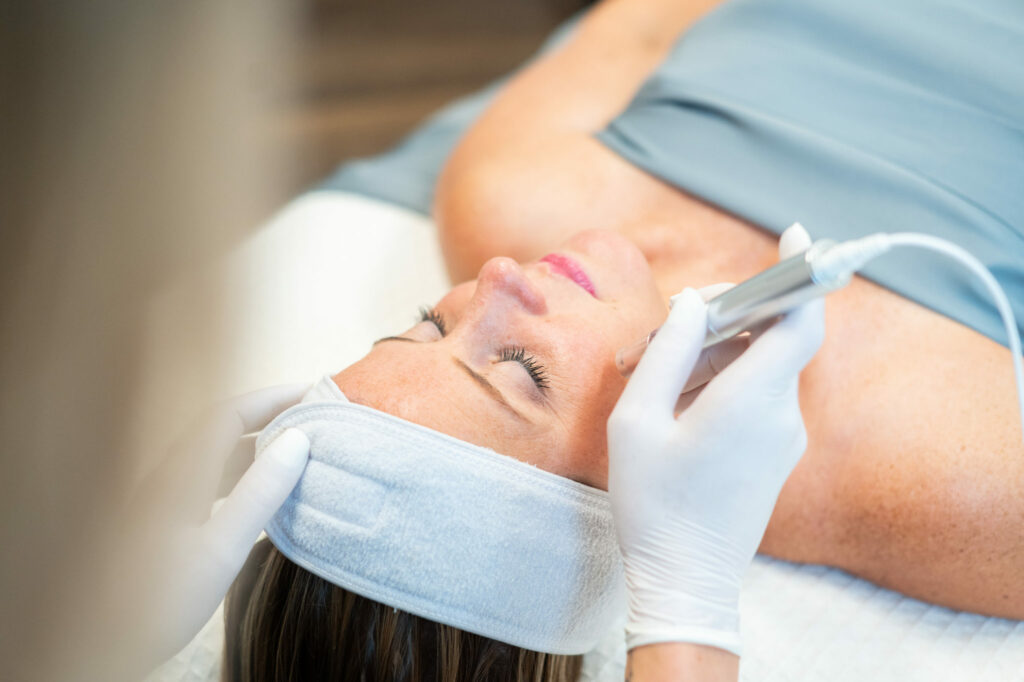 Microneedling treatment being performed