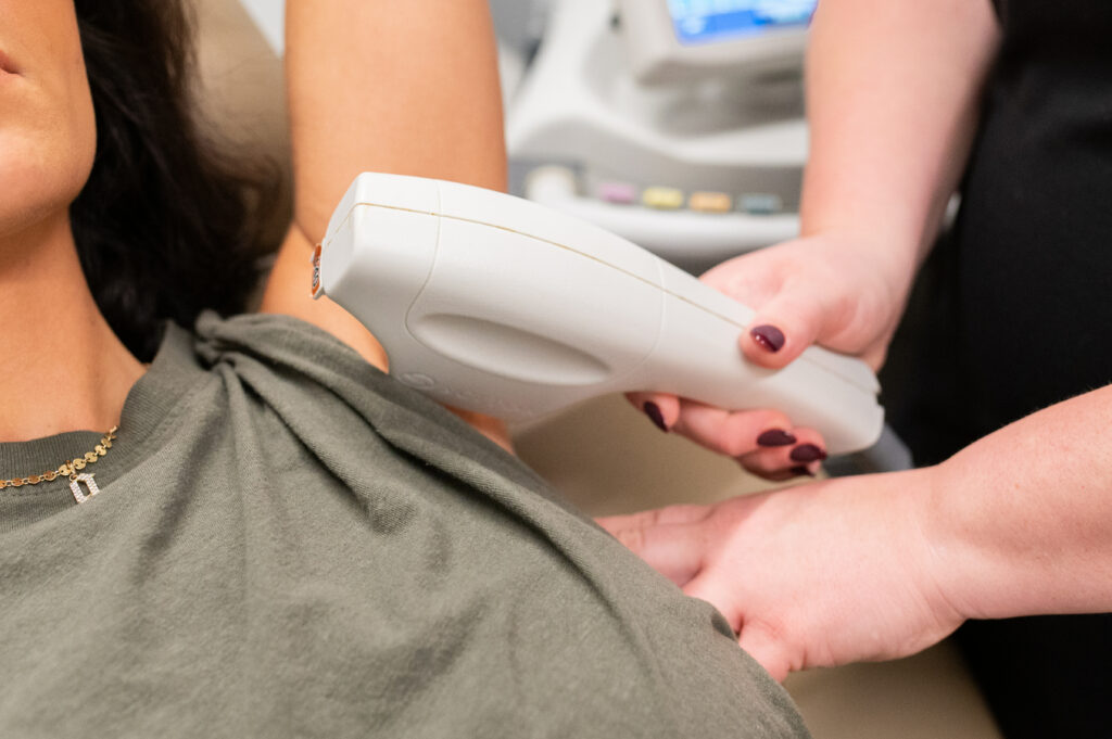 Paige performing underarm laser hair removal