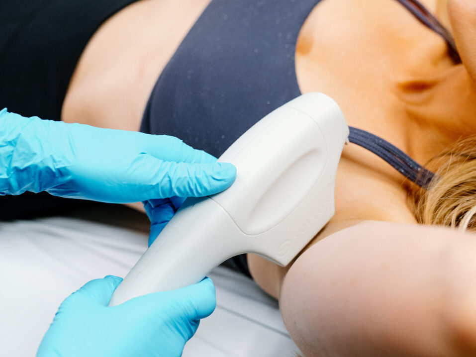 How Long Does Laser Hair Removal Last?