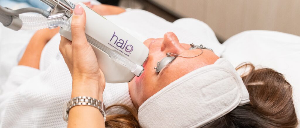 Halo Skin Resurfacing Being Performed On A Patient