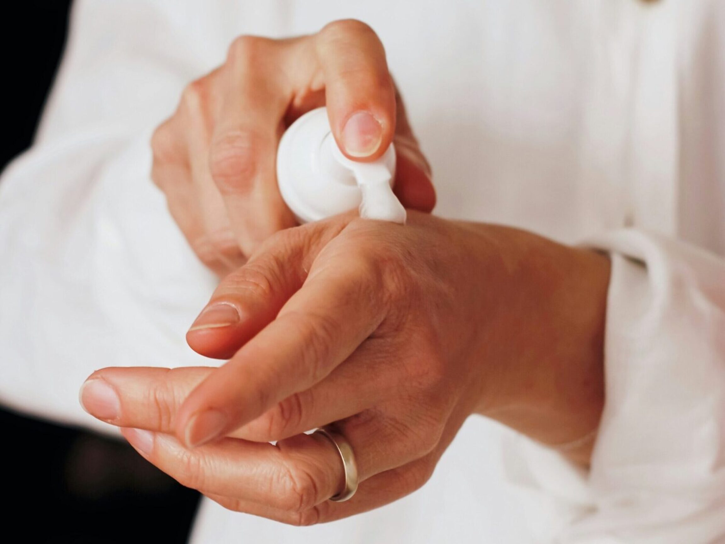 A person applying lotion to their hands after experiencing a sunburn