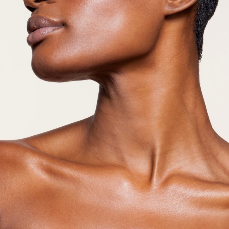 Kybella injections results