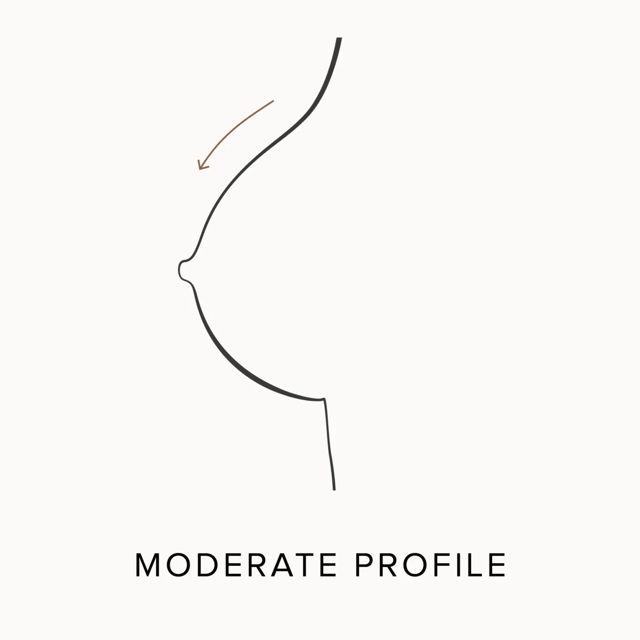 Diagram demonstrating what a moderate profile breast implant looks like