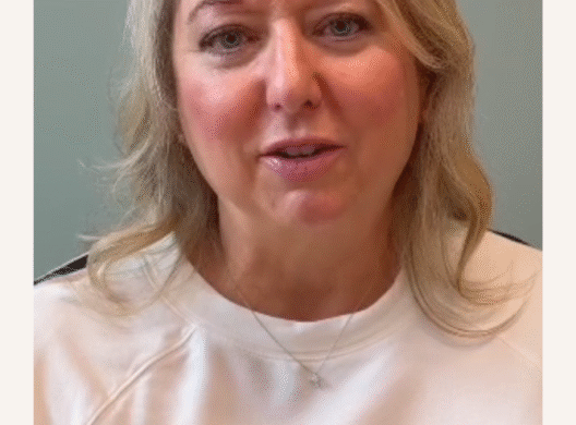 A Comfortable Upper Blepharoplasty Experience