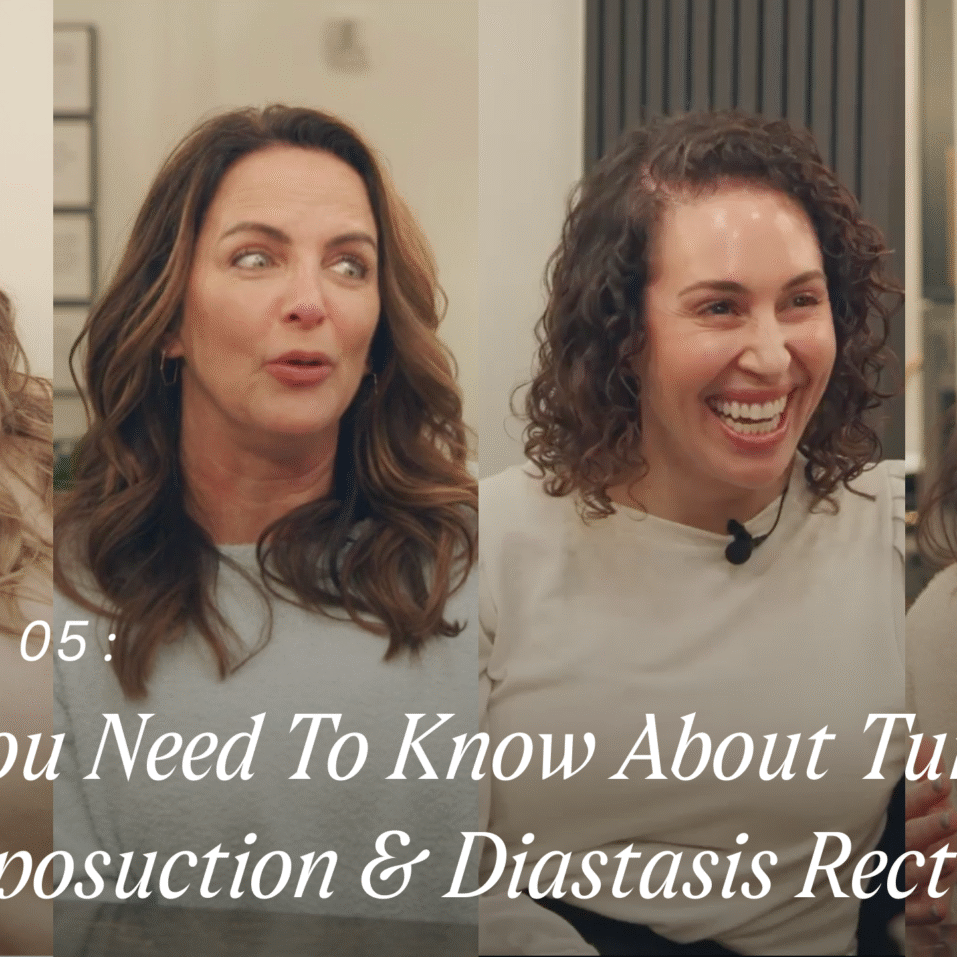 Episode 5: What To Know About Tummy Tuck, Liposuction & Diastasis Recti