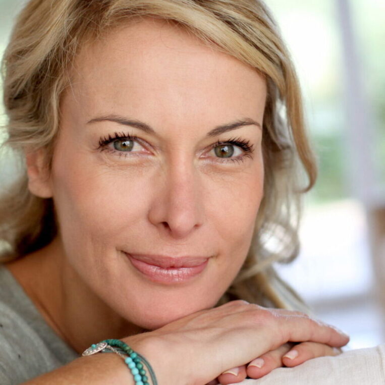 A patient who underwent an in-office upper blepharoplasty