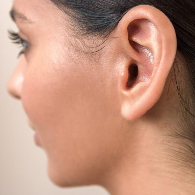 A posed photo of a woman showcasing her ears after ear pinning surgery