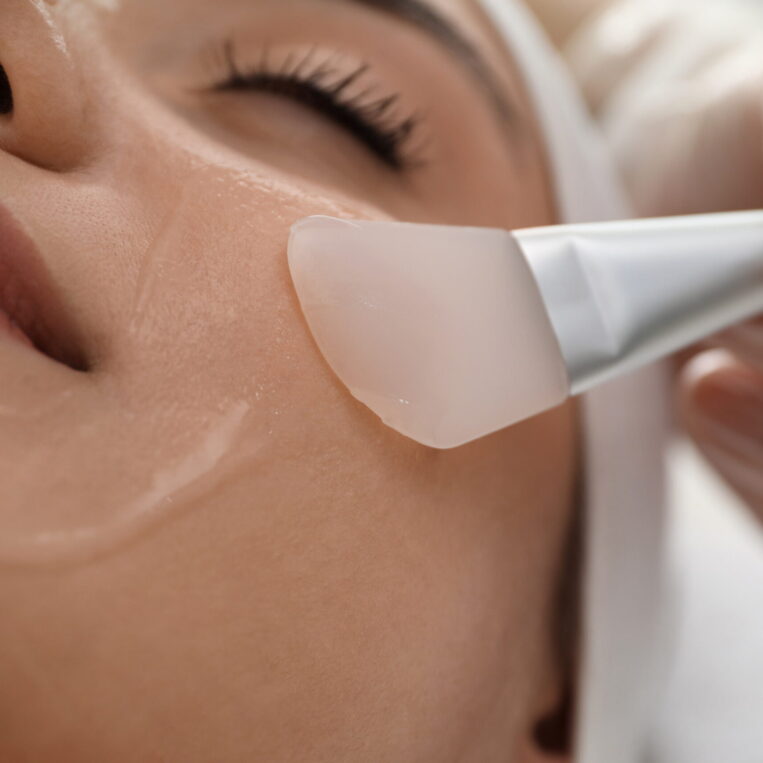 A gentle chemical peel being applied to a woman patient's face